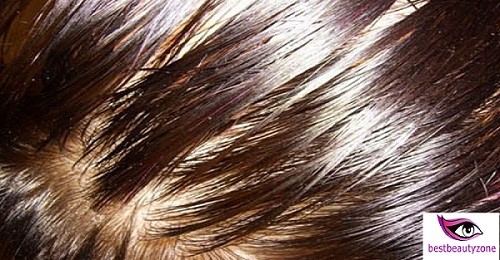 oily scalp with dry hair