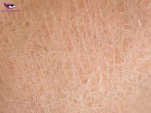 dry skin patches legs