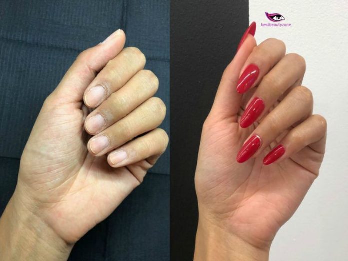how to remove gel nail extensions