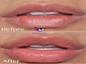 how long does lip gloss last