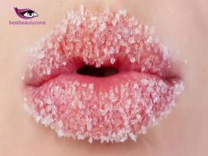 reasons for chapped lips
